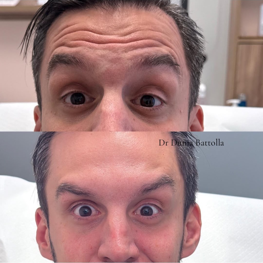 Prima e dopo i trattamenti 9