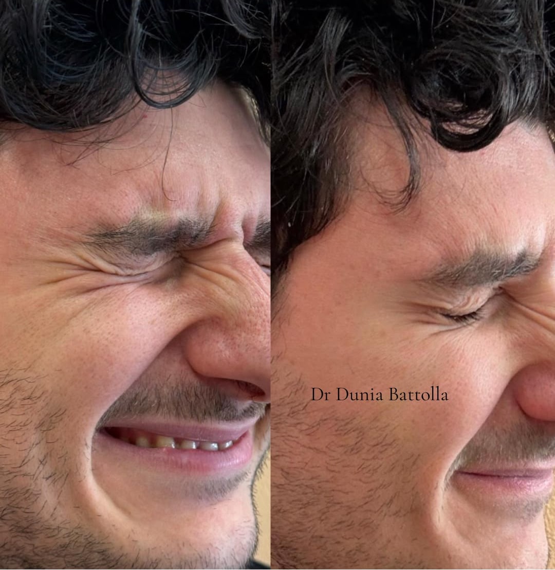Prima e dopo i trattamenti 25
